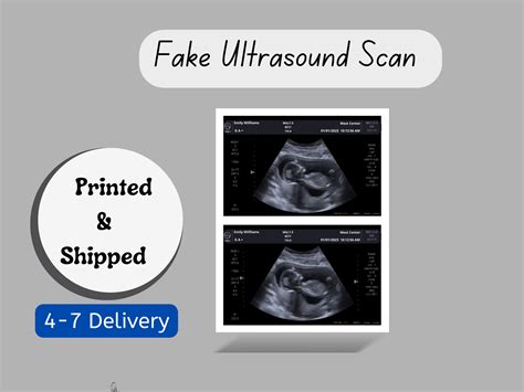 Personalized Fake Ultrasound Picture | PRINTED & SHIPPED!! Customizabl