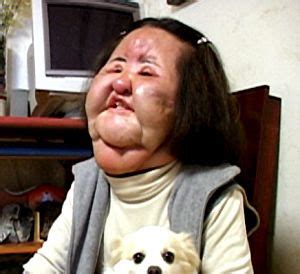 Viral Photos Worst Cosmetic Surgery Disasters Hang Mioku The Korean