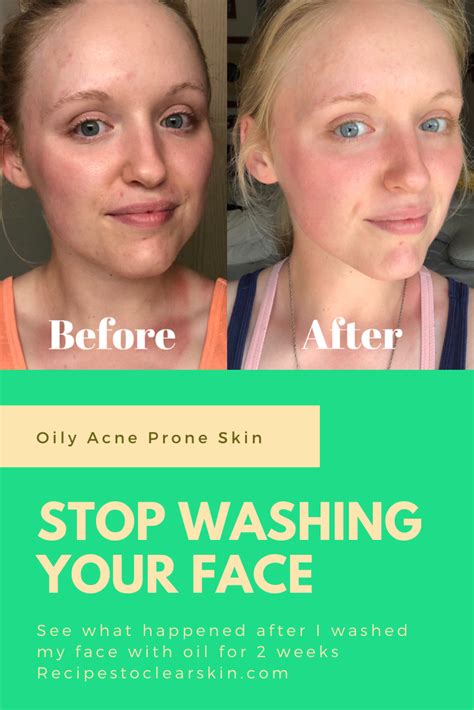 Stop Washing Your Face Natural Skin Care Routine Diy Natural Beauty