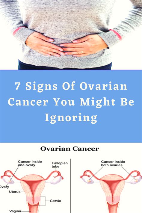 When this process begins, there may be no or only vague symptoms. 7 Signs Of Ovarian Cancer You Might Be Ignoring