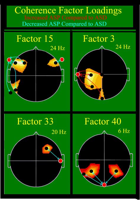 What exactly is the difference? Autism and Asperger's are different... at least on EEG - Vector