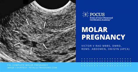 Molar Pregnancy Point Of Care Ultrasound Certification Academy