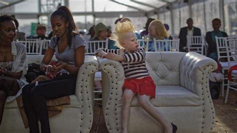 Photos Kenyan Pageant For People With Albinism Fights Social Stigma