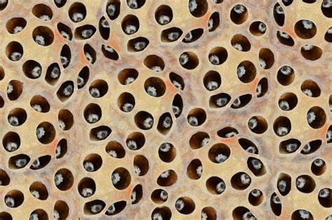 What Is Trypophobia Fear Of Holes Symptoms Causes And Treatment