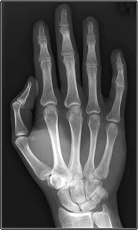 Clinical Anatomy Radiology Ap Hand