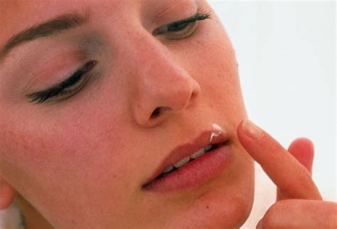 Oral herpes involves the face or mouth. Safe And Proven Treatment For Herpes Simplex 1 and 2 ...