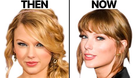 Taylor Swift NEW FACE Plastic Surgery Analysis Oasis Medical Aesthetics