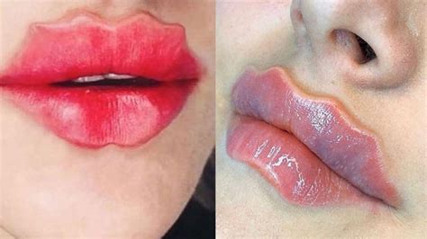 Bizarre Beauty Trend Makes Russian Girls Go Crazy For Wavy Lips