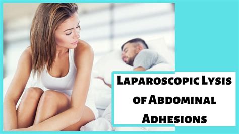 Laparoscopic Lysis Of Abdominal Adhesions Medical Knowledge Youtube