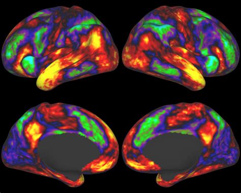 First Results From Brain Mapping Project Ready For Download St Louis