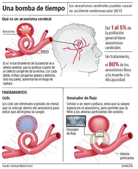 Conheça os sinais, tratamentos e possíveis sequelas. SALUD, ARTE, CULTURA Y ESPECTACULO: Nueva terapia contra los aneurismas cerebrales