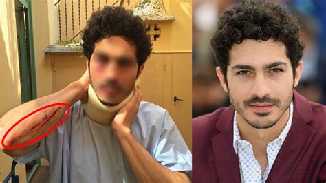 Chino miranda, quien ahora se hace llamar chyno tras su separación del popular dúo chino & nacho, es un cantante, compositor, productor y actor venezolano. ¿Qué le pasó? Impactantes fotos de el Chino Darín ...