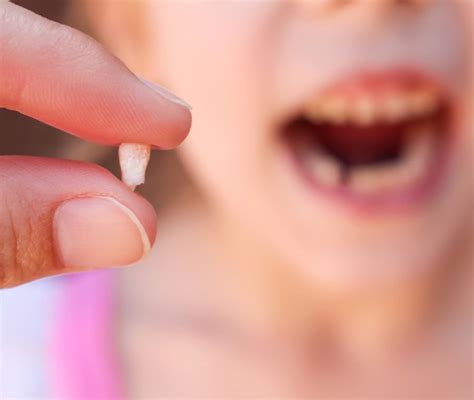 Denti Da Latte Quanti Sono E Quando Cadono Nostrofiglioit