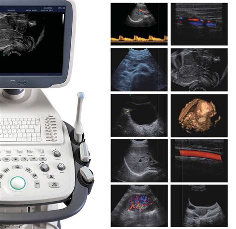China B Mode Ultrasound Color Doppler Diagnostic System China Color
