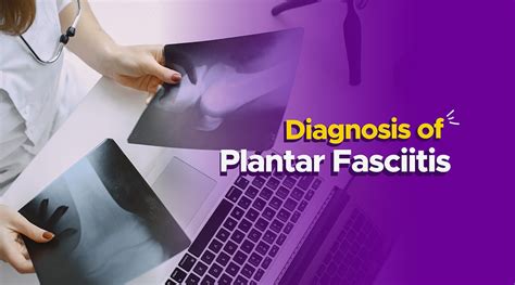 Understanding Plantar Fasciitis What You Need To Know Myfrido