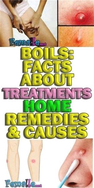 Home Remedies To Get Rid Of Boil Boils Treatment Get Rid Of Boils