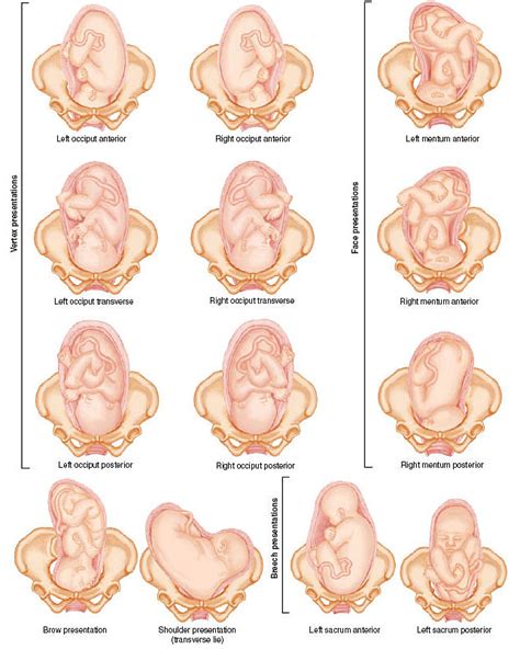 fetal positions nursing nclex pinterest midwifery ob nursing and school