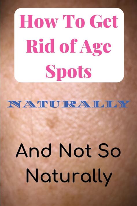 How To Get Rid Of Age Spots Naturally And Not So Naturally Age Spots On Face Liver Spot
