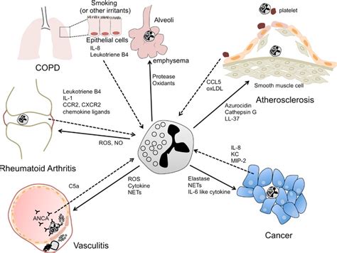 Neutrophils In Various Diseases Neutrophils Play A Significant Role In