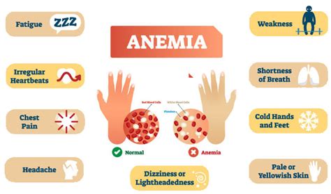 Whats Anemia Causes Symptoms And Treatments Sunexport