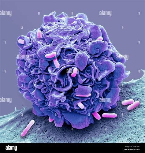 Macrophage Engulfing Li Bacteria Coloured Composition Scanning