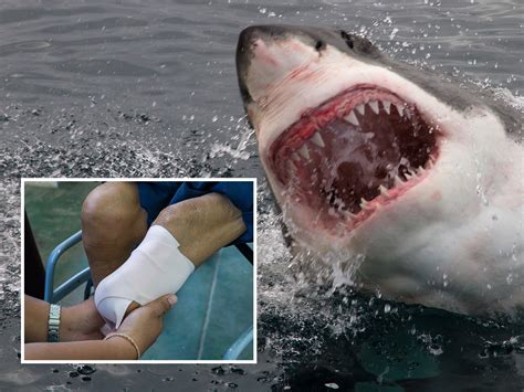 Florida Cheerleader Leg Amputation Scheduled After Shark Attack Trendradars Uk