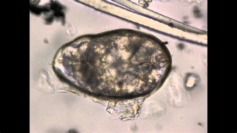 Scabies Mite In Egg Youtube