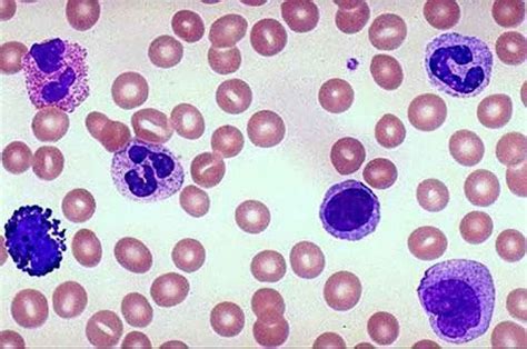 I Leucociti Caratterstiche Esame Del Sangue Classificazione