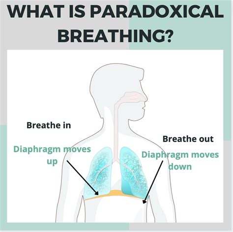 What Is Paradoxical Breathing — Rise To Shine