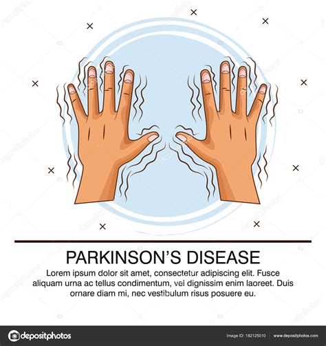 Parkinsons Disease Infographic — Stock Vector © Jemastock 182125010