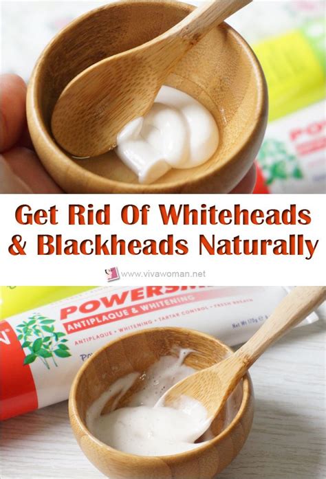 How To Remove Whiteheads And Blackheads Naturally Healthy Glow