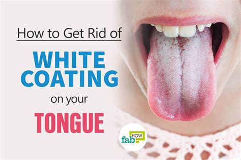 White Coating On Tongue Your Tongue Could Tell Whether Or Not You