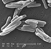 Tuberculosis - Wikipedia