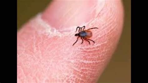 Ticks And Lyme Disease Youtube