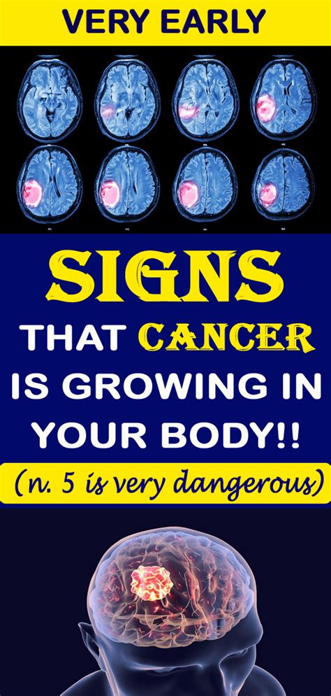 5 Early Cancer Symptoms You Shouldnt Ignore World Of Health