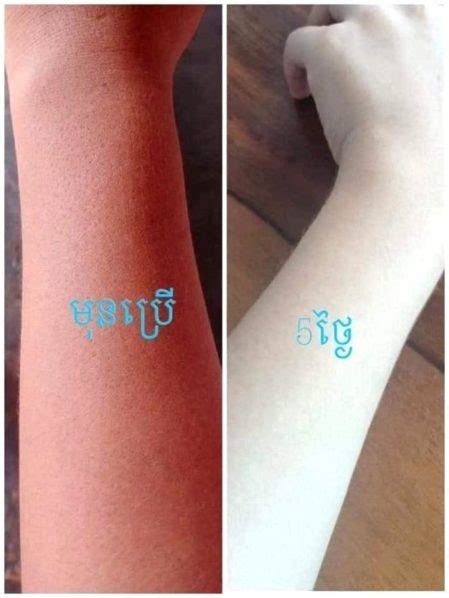 Whitening Creams Before And After Photos Spark Controversy — Guardian
