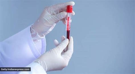 Can Cancer Blood Tests Live Up To Promise Of Saving Lives Health