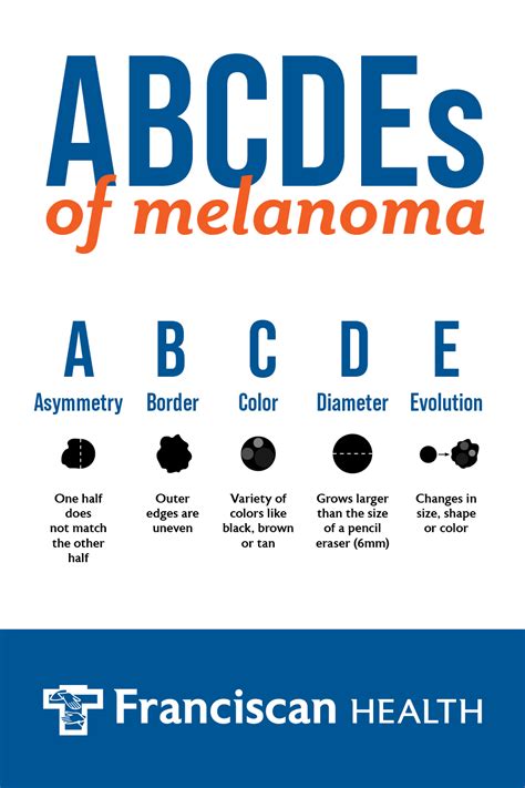 The Abcdes Skin Cancer Assessment Franciscan Health
