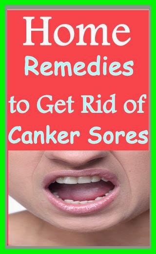 Home Remedies To Get Rid Of Canker Sores Handy Diy