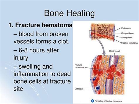 Hematoma Formation Types Symptoms Pictures Causes And Treatments