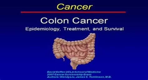 Download Free Medical Colon Cancer Epidemiology Treatment And