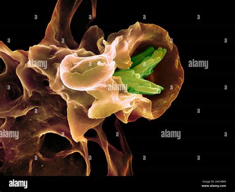 Macrophage Engulfing Tb Bacteria Coloured Scanning Electron Micrograph