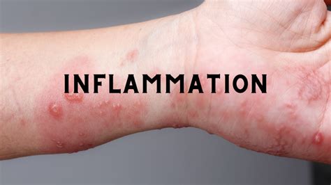 Everything You Need To Know About Inflammation And Your Skin Dna
