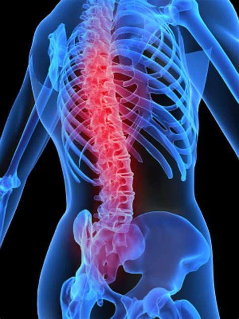 Treatment Of Diseases Spinal Stenosis Of The Lumbar Spine Causes