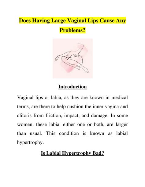 Ppt Does Having Large Vaginal Lips Cause Any Problems Powerpoint Presentation Id7989145