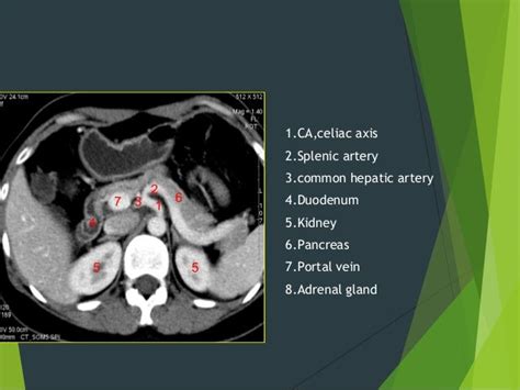 Imaging Features Of Hepatobiliary And Pancretic Ds