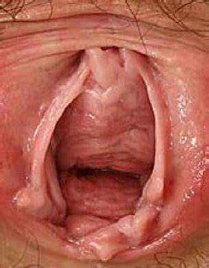 Penis Inside Vagina IgFAP