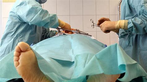 Massive Payout After Surgeons Remove Wrong Testicle