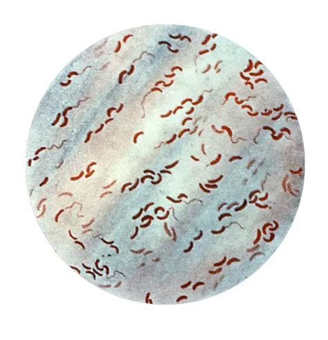 Vibrio Bacteria Overview Examples Shape Structure And Infection