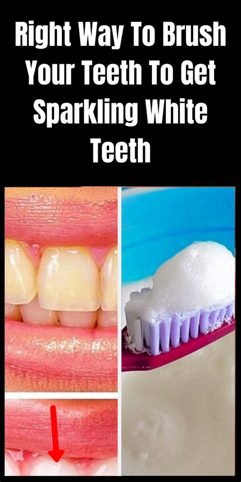 Right Way To Brush Your Teeth To Get Sparkling White Teeth Sparkling